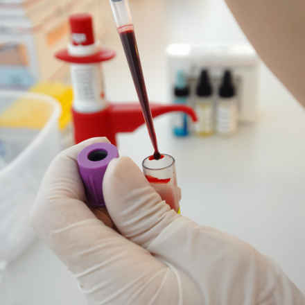 A blood test