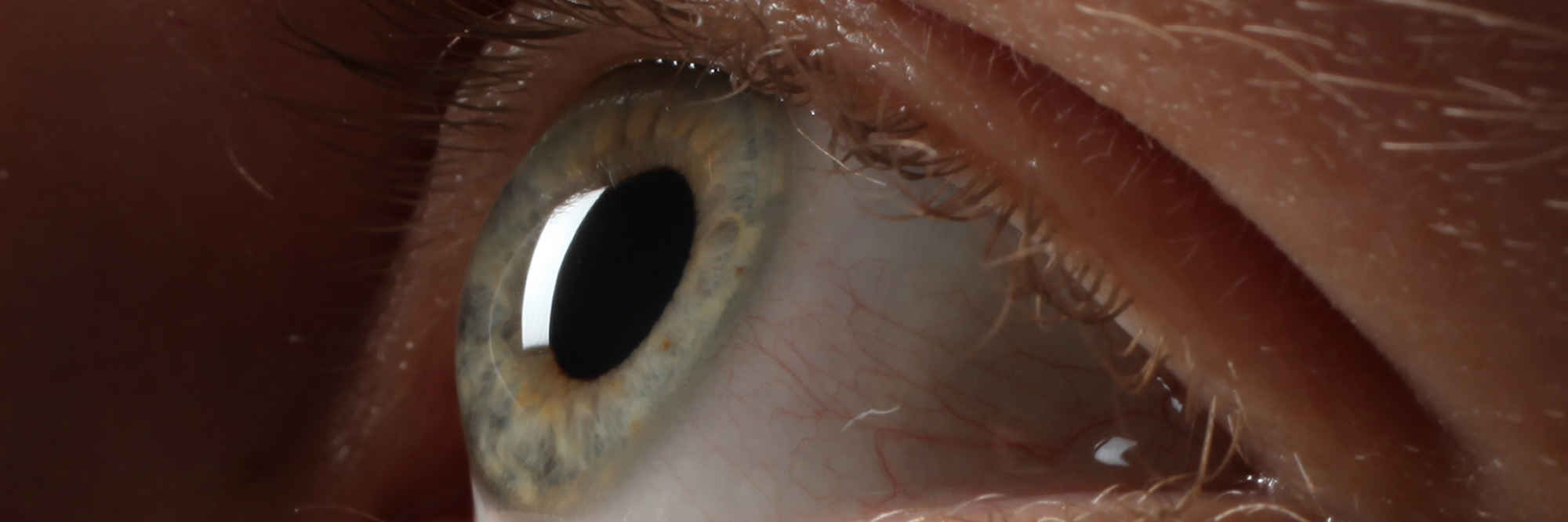 Floaters primary image